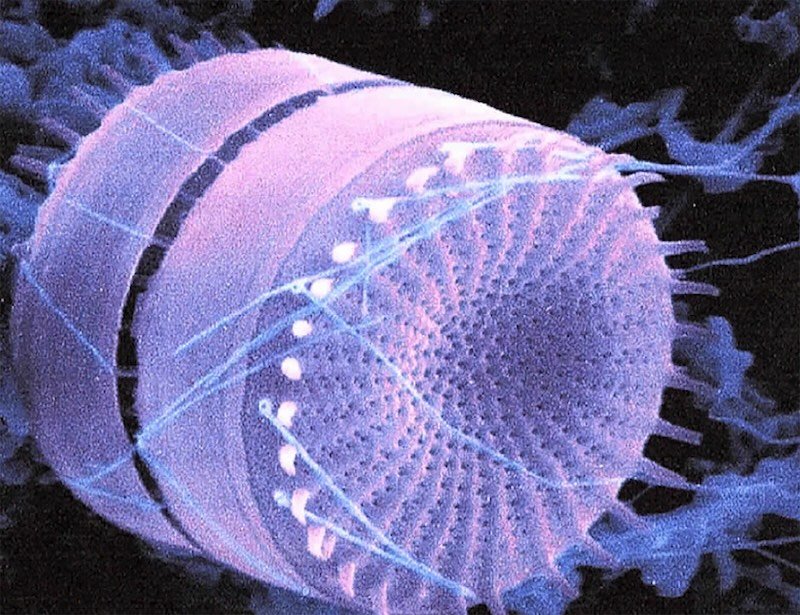 Diatom under a microscope